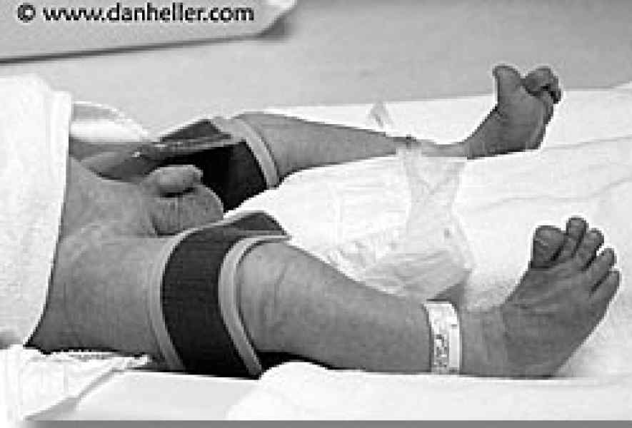 circumcision_00.jpg