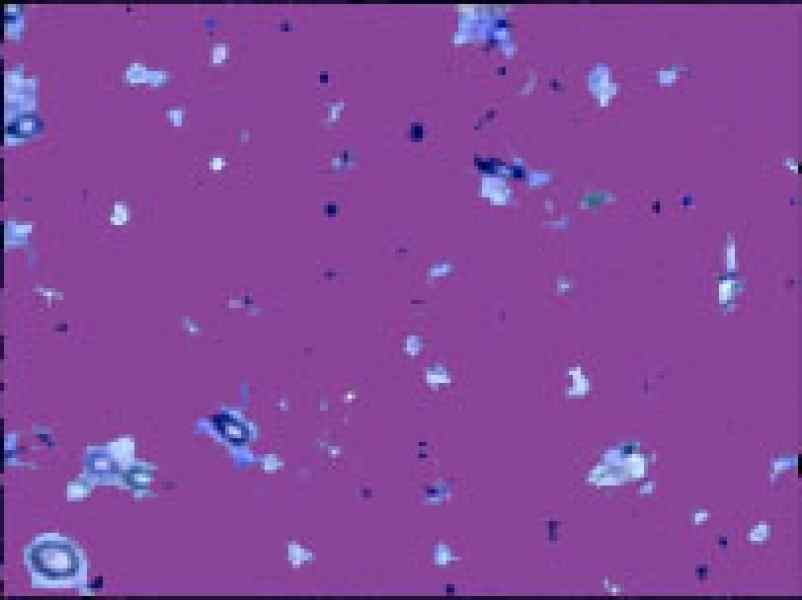 sperm.jpg